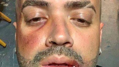 Photo of Cantante Nacho sube fotografía con el rostro golpeado y sus detractores explotan en su contra